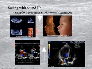 Seeing with sound II Doppler Ultrasound Obstetrical Ultrasound