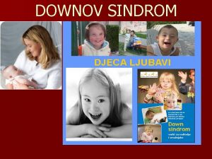 Downov sindrom stupnjevi