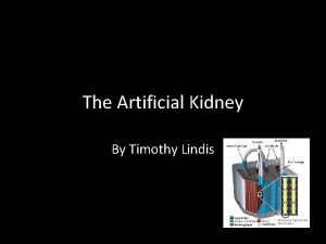 The Artificial Kidney By Timothy Lindis The Kidneys