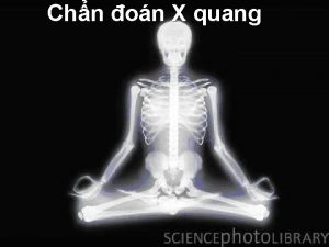 Chn on X quang Ni dung Gii thiu