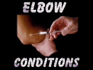 ELBOW DISLOCATIONS ELBOW DISLOCATIONS When discussing elbow dislocations