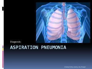 Pneumonia lisa