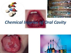 Chemical Injuries of Oral Cavity Introduction Oral cavity
