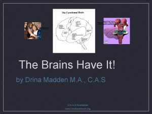 The Brains Have It by Drina Madden M