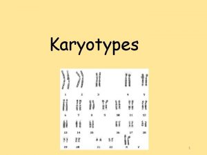 Karyotypes 1 I What is a Karyotype Karyotype