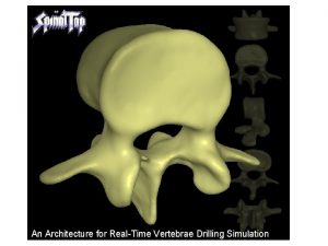 An Architecture for RealTime Vertebrae Drilling Simulation Virtual