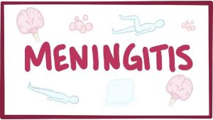 Meningitis triad
