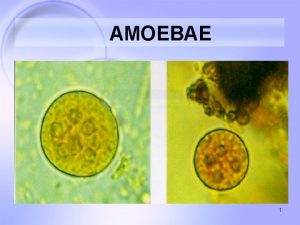 AMOEBAE 1 Entamoeba histolytica Morphologic forms 1 Active