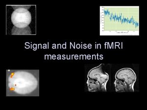 Signal and Noise in f MRI measurements Tradeoffs