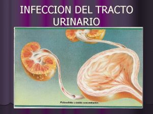 Infección tracto urinario