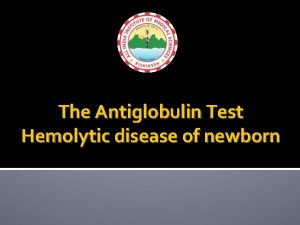 Direct coombs test newborn