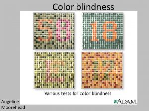Color blindness Angeline Moorehead Facts Color blindness is
