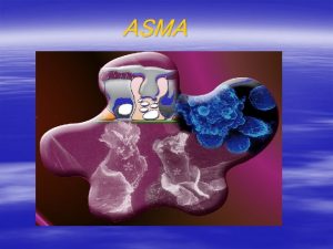 ASMA asma GINA 2004 UPDATE Iniciativa Global para
