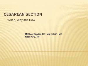 CESAREAN SECTION When Why and How Matthew Snyder