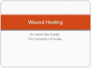 Wound Healing Dr Ashraf Abu Karaky The University