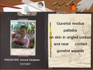 Gunshot residue patterns on skin in angled contact