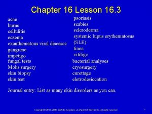 Chapter 16 Lesson 16 3 acne burns cellulitis