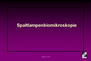 Spaltlampenbiomikroskopie 94058 1 S PPT Teile der Spaltlampe