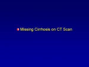Can ct scan miss cirrhosis