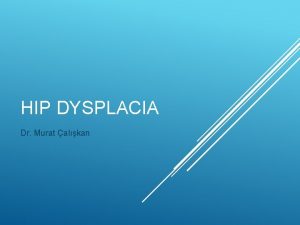 Hip dysplacia