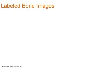 Acromial end