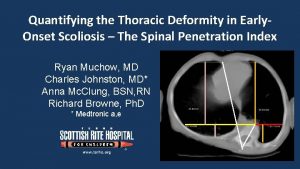 Quantifying the Thoracic Deformity in Early Onset Scoliosis