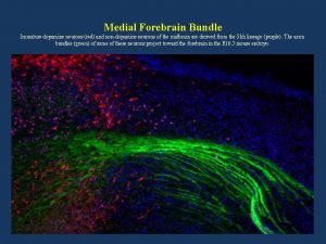 Medial Forebrain Bundle Immature dopamine neurons red and