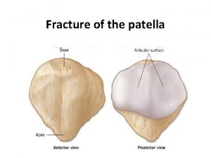 Fracture of the patella Cont Fig Anatomy Largest