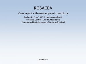 ROSACEA Case report with rosacea papulo pustuloza Bachevski