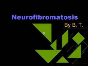 Neurofibromatosis By B T What is Neurofibromatosis u