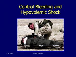 Control Bleeding and Hypovolemic Shock Core Skills Control