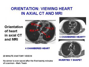 Axial view of heart