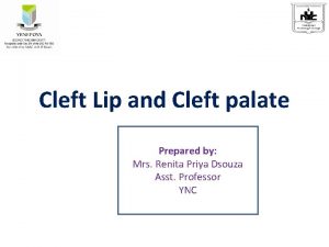 Cleft Lip and Cleft palate Prepared by Mrs