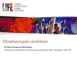 Oropharyngeal candidiasis Dr Riina RautemaaRichardson University of Manchester