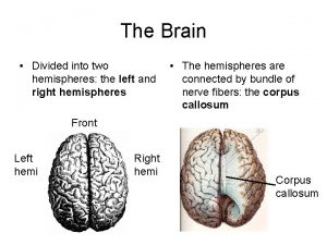 The Brain Divided into two hemispheres the left