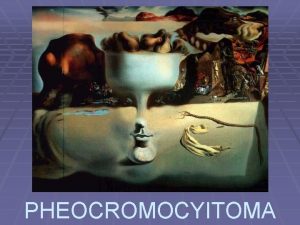 PHEOCROMOCYITOMA History adrenal medulla 1805 Cuvier Makes the