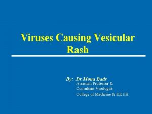 Viruses Causing Vesicular Rash By Dr Mona Badr