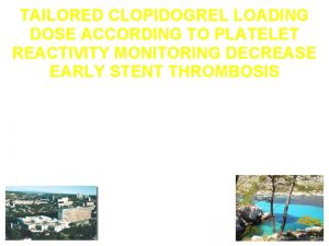 TAILORED CLOPIDOGREL LOADING DOSE ACCORDING TO PLATELET REACTIVITY