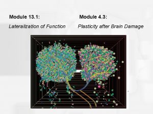 Module 13 1 Module 4 3 Lateralization of