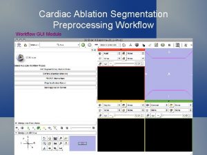 Cardiac Ablation Segmentation Preprocessing Workflow GUI Module Cardiac