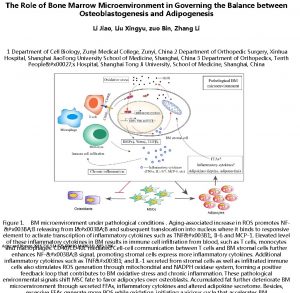 The Role of Bone Marrow Microenvironment in Governing