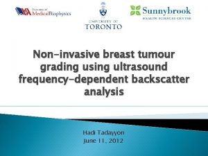 Noninvasive breast tumour grading using ultrasound frequencydependent backscatter