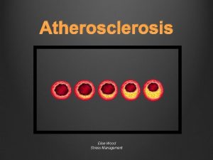Atherosclerosis Elise Wood Stress Management What is atherosclerosis