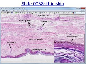 Slide 0058 thin skin hypodermis sweat glands sweat