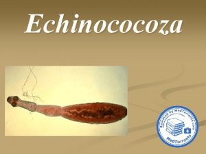 Echinococoza Foxes may be a reservoir of zoonotic