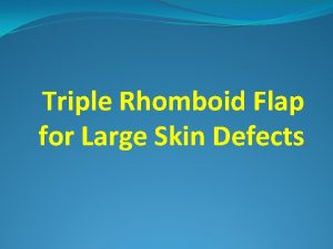 Triple Rhomboid Flap for Large Skin Defects Larissa