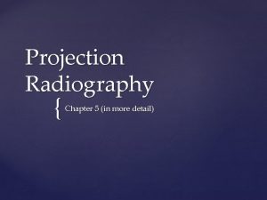 Projection Radiography Chapter 5 in more detail Introduction