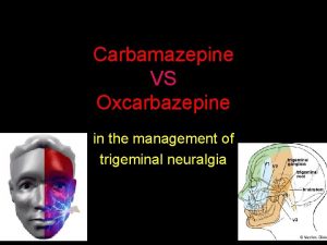 Carbamazepine VS Oxcarbazepine in the management of trigeminal