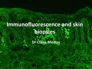 Immunofluorescence and skin biopsies Dr Claire Murray Procedure