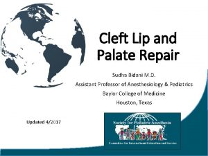 Cleft Lip and Palate Repair Sudha Bidani M